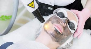 máy laser xóa xăm liên hệ 0975 726 172