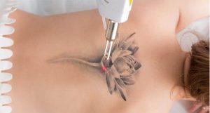 máy laser trục khuỷu tốt nhất hiện nay