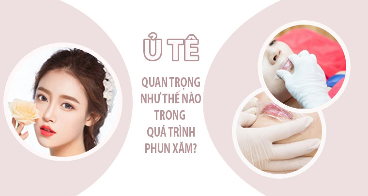 Ủ tê quan trọng như thế nào?