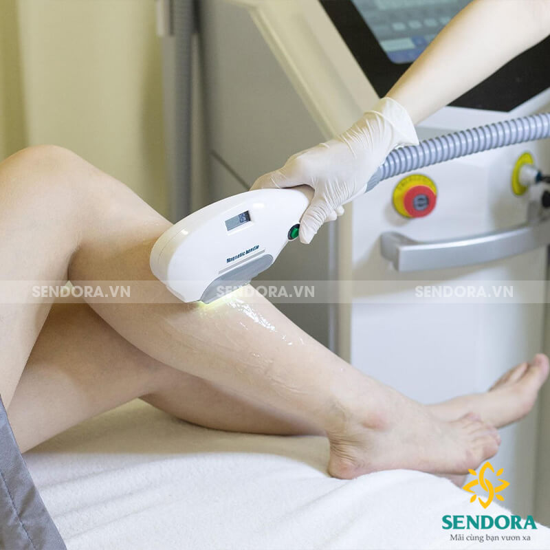 Máy triệt lông là thiết bị sử dụng công nghệ ánh sáng hoặc laser để triệt lông