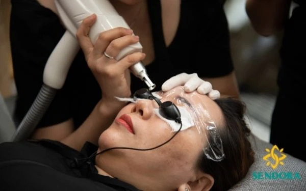 Công Nghệ Laser Q-Switched ND Yag Có Độ Dài Xung 1 Phần Tỷ Giây