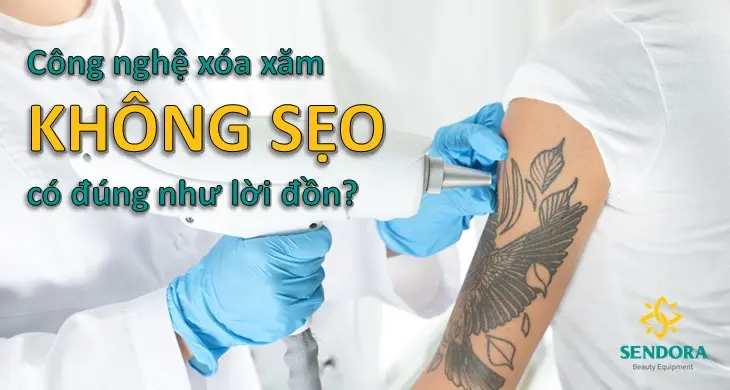 Công Nghệ Xóa Xăm Không Sẹo Có Đúng Như Lời Đồn?