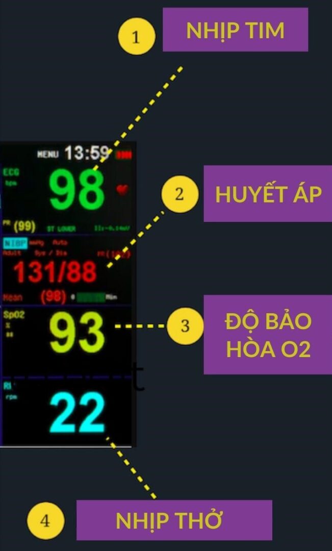 Cách đọc các chỉ số trên máy monitor theo dõi bệnh nhân 8 Các chỉ số trên máy monitor dạng số
