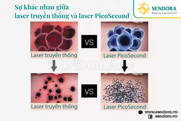 Laser PicoSecond có khả năng phá vỡ sắc tố mịn hơn, nhuyễn hơn