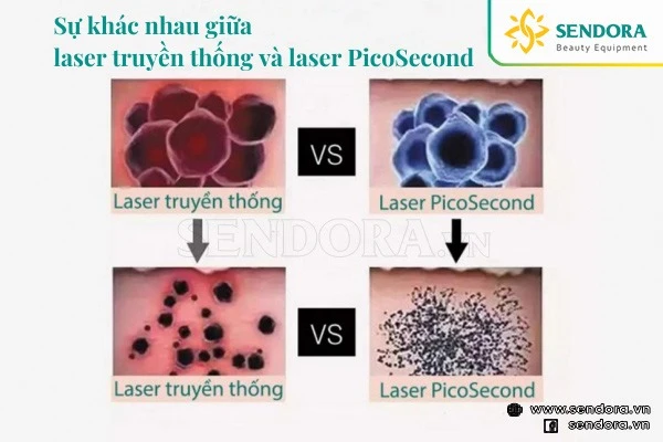 Laser PicoSecond có khả năng phá vỡ sắc tố mịn hơn, nhuyễn hơn