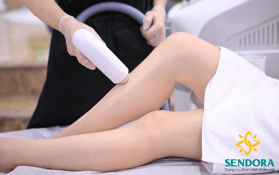 Tia laser giúp triệt lông hiệu quả, an toàn hơn