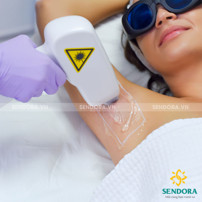 Máy triệt lông Diode Laser có thể triệt lông ở những vùng da nhạy cảm như vùng nách, bikini...