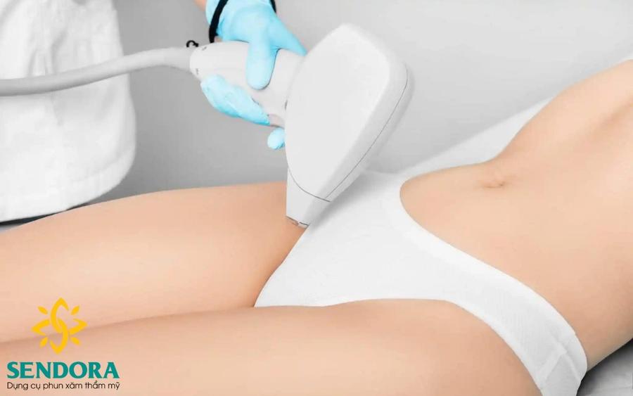 Máy Triệt Lông Bikini Diode Laser Là Gì?