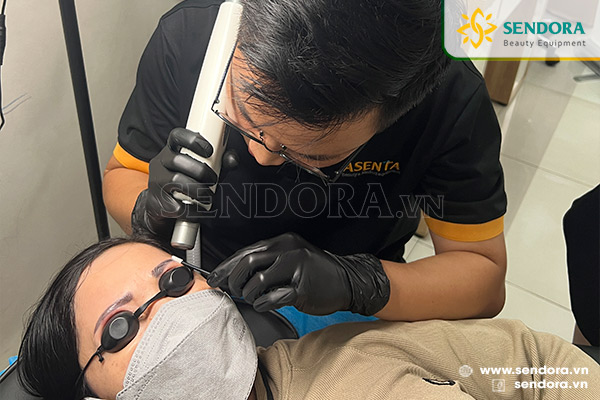 Máy laser xóa xăm chân mày mang lại hiệu quả cao, an toàn