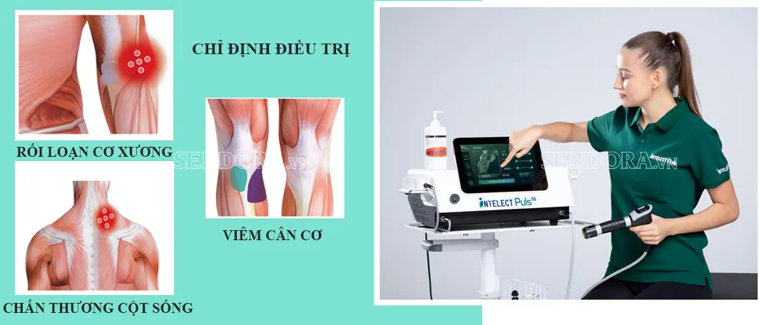 Ứng dụng cơ bản của máy xung kích intelect puls 50