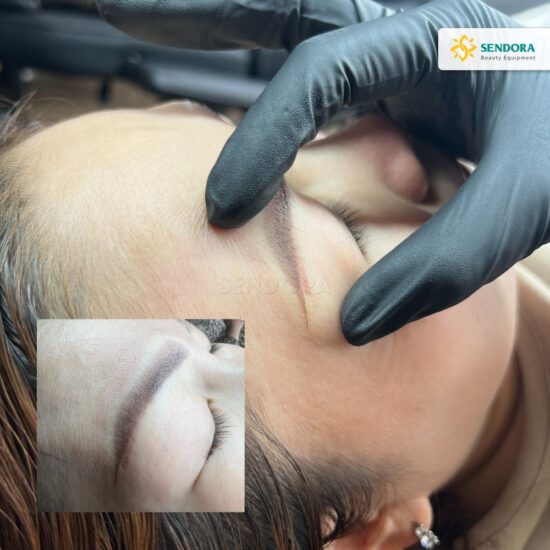 Bàn giao máy Laser CO2 Fractional Multixel